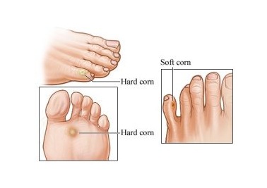 img/foot.jpg