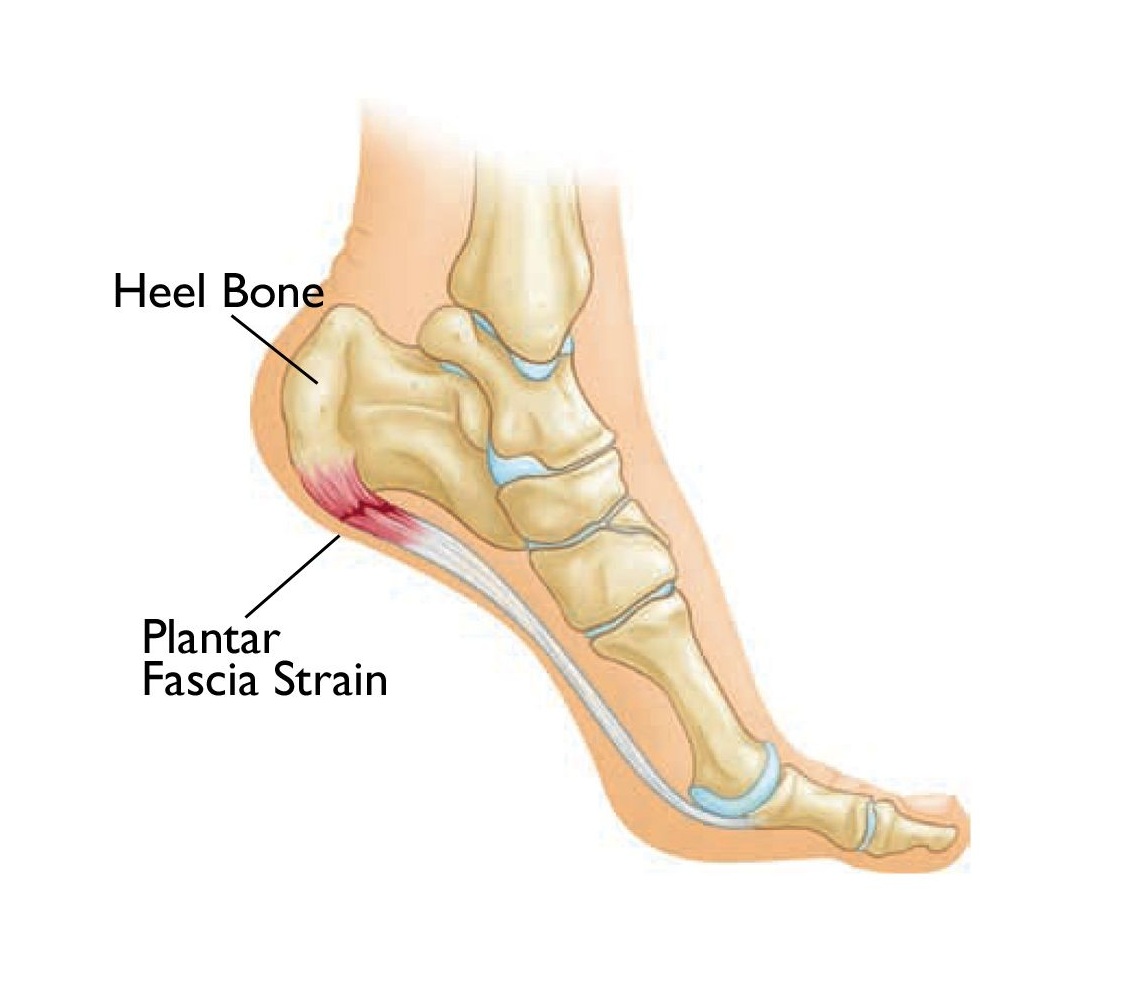 plantar.jpg